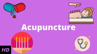 Acupuncture What You Need to Know [upl. by Silvie703]