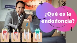 ¿Necesitas un tratamiento de ENDODONCIA  Dr Alvaro Campos [upl. by Artus]