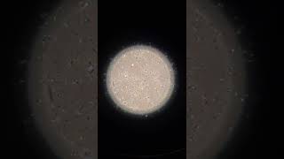 Sperm under a microscope [upl. by Ainej874]