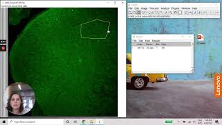 ImageJ  Densitometry using MAX projection image [upl. by Janna]