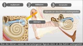 Wie das Gehör und das Hören mit einem CochleaImplantat funktioniert [upl. by Duquette]