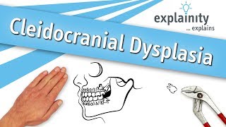 Cleidocranial Dysplasia explained explainity® explainer video [upl. by Aiuqenehs]