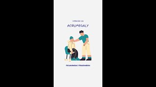 Acromegaly [upl. by Austen]