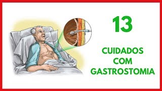 Cuidados de Enfermagem com Gastrostomia [upl. by Ojaras]