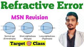 Refractive Errors  Hypermetropia  Myopia  Astigmatism  MSN Important Topic Eye MSN [upl. by Thibault500]