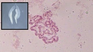 Identifying characters of polytene chromosome of Drosophila sp [upl. by Lindbom632]