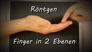 Röntgen Finger Einstelltechnik Anatomie Fehler [upl. by Ernie]