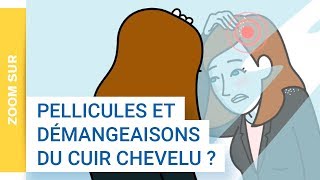 Zoom Sur  La dermite séborrhéique une affection cutanée bénigne à lorigine des pellicules [upl. by Anirrok]