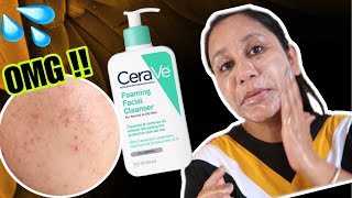 Cerave Foaming Cleanser For Oily Acne Prone Skin [upl. by Nysa]