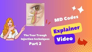 Tear Trough Video 2  Injection Techniques [upl. by Lewison]