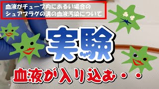 シュアプラグが血液汚染される！その瞬間！Np木村のゴールデンウィークの実験。 [upl. by Alrep]