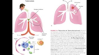 Mycobacterium tuberculosis [upl. by Oiramed]