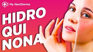 HIDROQUINONA Aclara manchas melasma y rosacea  Explicado por Dermatólogo [upl. by Lette279]