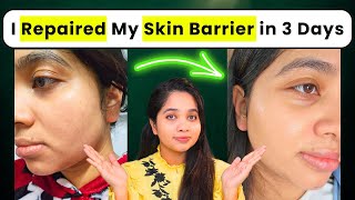 How I Repaired My Skin Barrier in 3 days at Home with Minimal Skincare Products [upl. by Bilat555]