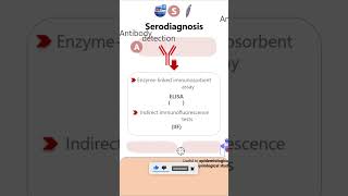 SerodiagnosisGiardia lamblia parasitology microbiology pathology diagnosis neetpg neet [upl. by Turnheim946]