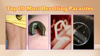 Top 10 Most Revolting Parasites [upl. by Yesnil687]