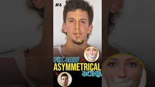 Fix Jaw Symmetry  Mewing Exercise [upl. by Chessa]