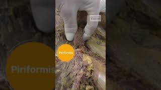 Piriformis Sciatic Nerve and Obturator Internus Anatomy [upl. by Fesoy]