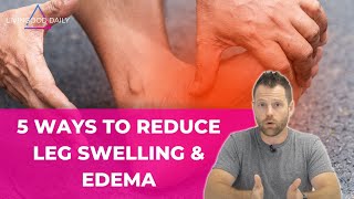 Reduce leg swelling edema  5 key remedies to rebalance your fluids Rebounding [upl. by Yllitnahc]