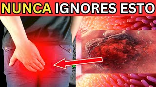 ¡Alerta 🚨 Los 8 Síntomas del Cáncer de Colon Que NO Debes Ignorar  Prevención y Tratamiento [upl. by Stoecker190]