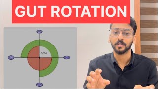 Gut Rotation Anatomy Malayalam LectureOmphalocele [upl. by Pitt]