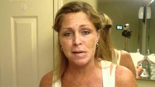 Skin Cancer My Vlog Journal Treatment W EFUDEX vid5 [upl. by Jared914]