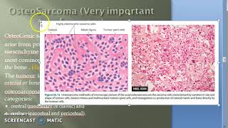 Pathology 828 a OsteoSarcoma OsteoGenic Bone Tumor Metaphysis Malignancy surface [upl. by Tenner]