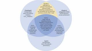 Antiplatelet vs Anticoagulant [upl. by Aidnama]