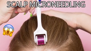 SCALP MICRONEEDLING AT HOME  HAIR LOSS TREATMENT AD [upl. by Elwood340]