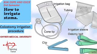 How To Irrigate Colostomy  Colostomy Irrigation  Stoma Irrigation Ospe And Osce Guide [upl. by Atiruam738]