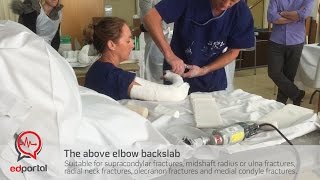 Above elbow backslab [upl. by Nellac]