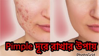 how to prevent acne I mahbuba shanta 2023 [upl. by Retniw]