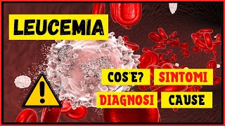 Leucemia Cosè Come si sviluppa Come viene diagnosticata Quali sono i sintomi e le cause [upl. by Isak]