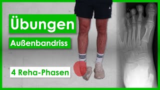 Bänderriss im Sprunggelenk⎮4 PhasenAnleitung⎮Übungen [upl. by Eiznil]