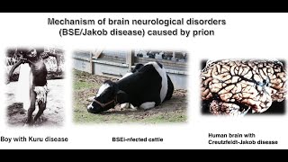 Mechanism of brain neurological disorders BSEJakob disease caused by prion proteins [upl. by Akcemat]