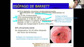 Esófago de BarretParte 1 [upl. by Anairad]