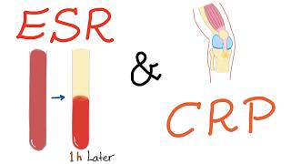 ESR and CRP [upl. by Hy]