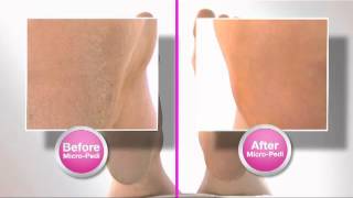 Emjoi MICRO Pedi TV Commercial August 2012 [upl. by Manthei]