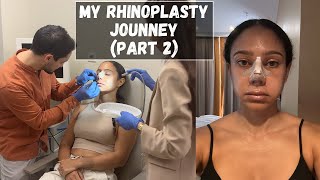 My RHINOPLASTY JOURNEY amp SEMI REVEAL Part 2  Tiana Peri [upl. by Retrac]