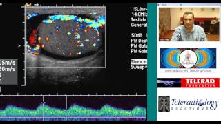 Ultrasound of Acute Epididymo Orchitis by Dr Arjun Kalyanpur [upl. by Nanah908]