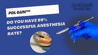 PDL gun™  Get up to 99 successful anesthesia rate with this Intraligamental Gun Syringe [upl. by Dowd]