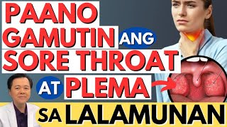 Paano Gamutin ang Sore Throat at Plema sa Lalamunan By Doc Willie Ong Internist and Cardiologist [upl. by Aiuhsoj]