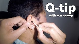 Elderly Womans Ear Cleaning amp Earwax Removal [upl. by Nedroj]