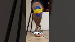 Effective Taping Strategies for Patellofemoral Pain Relief physiotherapy [upl. by Oiciruam]