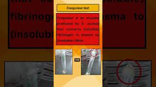 Coagulase test [upl. by Thoer619]