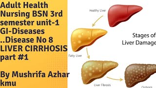 Adult Health Nursing BSN 3rd semester Unitl GIDisease Disease No 8 Liver cirrhosis part 1 [upl. by Naitsihc435]