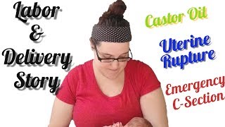 Labor and Delivery Story Castor Oil Success Uterine Rupture Emergency C Section [upl. by Eilema660]