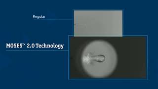 MOSES™ 20 Technology Holmium Bubble for Lithotripsy [upl. by Inge318]