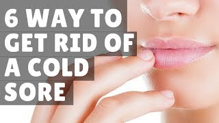 6 WAY to get rid of a cold sore home remedies fast overnight [upl. by Nooj]