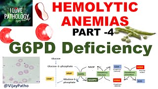 Hemolytic Anemias Part 4 G6PD Deficiency PathophysiologyMorphology clinical features [upl. by Seamus610]